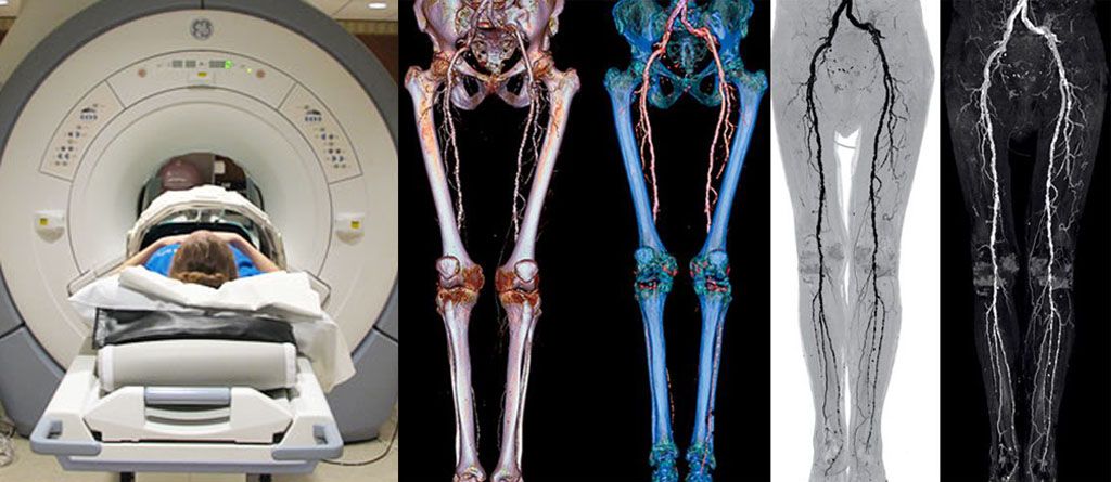 Способы диагностики укорочения конечностей